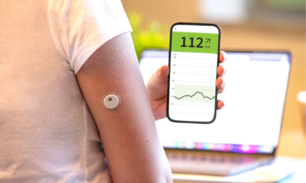 Person mit weißem T-Shirt trägt einen Glukosesensor am Oberarm und liest den Blutzuckerspiegel auf einem Smartphone ab. | © Rothenburg & Partner