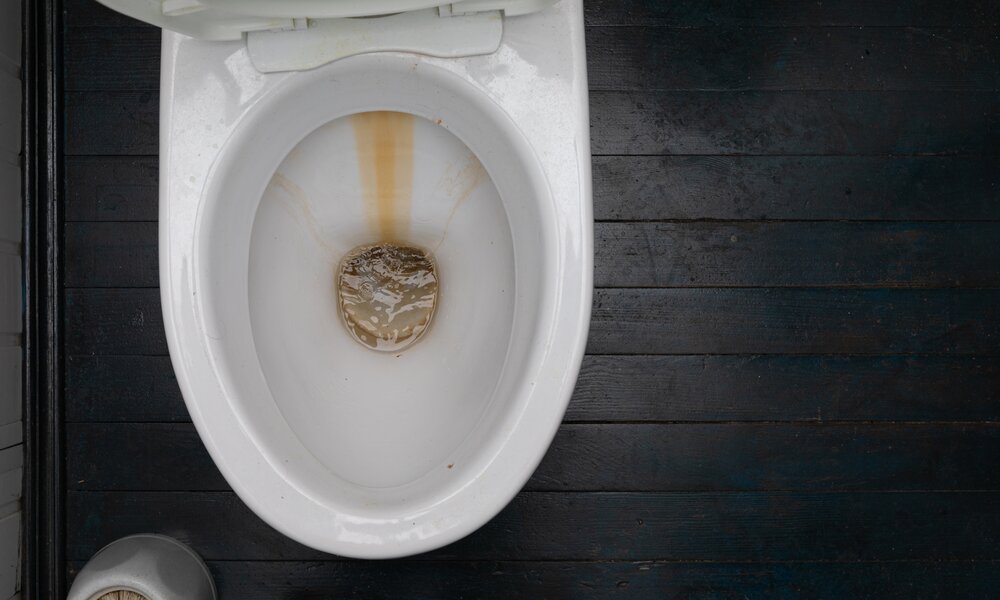 Geöffnete Toilettenschüssel mit sichtbarem Urinstein im Inneren, dunkler Holzfußboden und Toilettenbürste in der linken Ecke. | © Adobe Stock/ Ivan Traimak