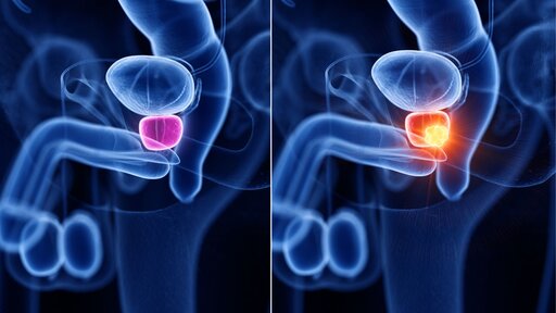 Schon gewusst? So verändert sich die Prostata mit 30, 40 und 50 Jahren! 