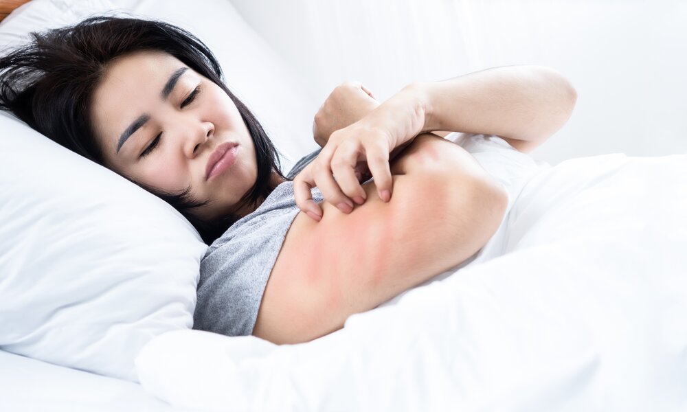 Nachdenkliche Frau liegt im Bett und reibt sich mit angespannter Miene eine stark gerötete Stelle am Oberarm. | © Adobe Stock/ doucefleur
