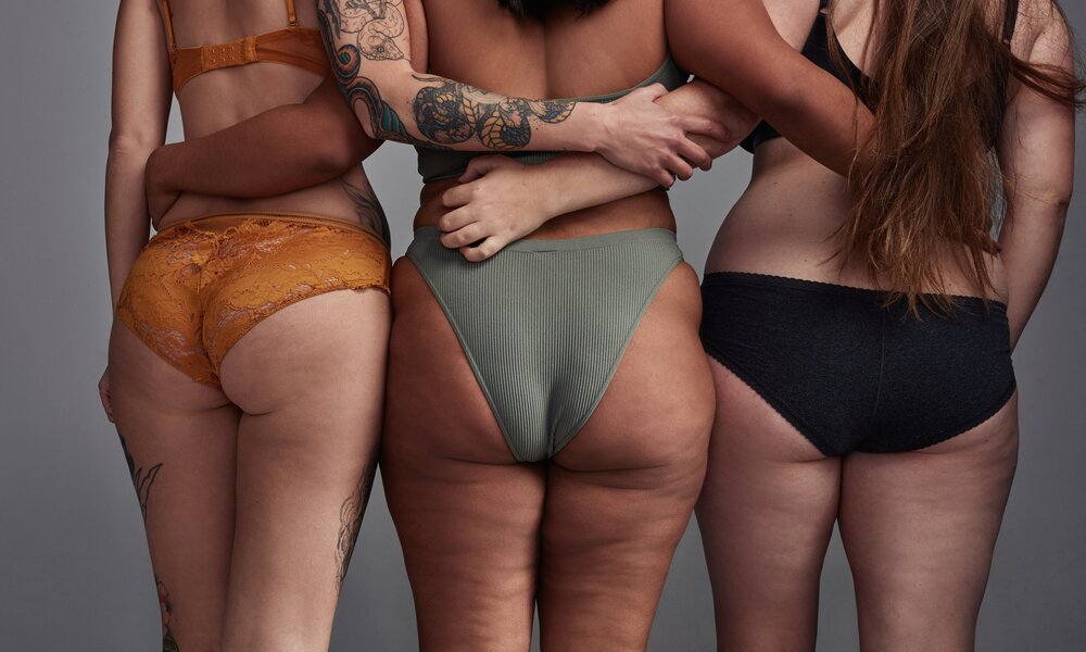 Cellulite_Geheimtipps | © Getty Images/LumiNola