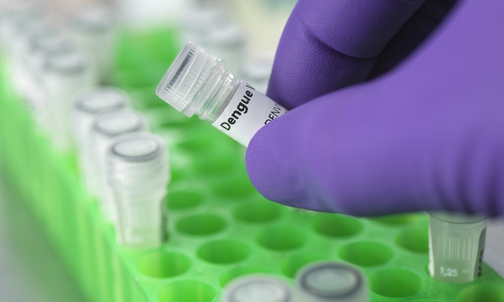 Probe des Dengue-Virus | ©  Getty Images / TEK IMAGE/SCIENCE PHOTO LIBRARY