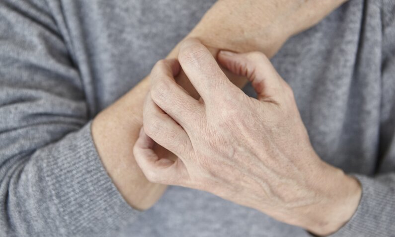 Frau kratzt trockene Haut | ©  Getty Images / Maria Fuchs