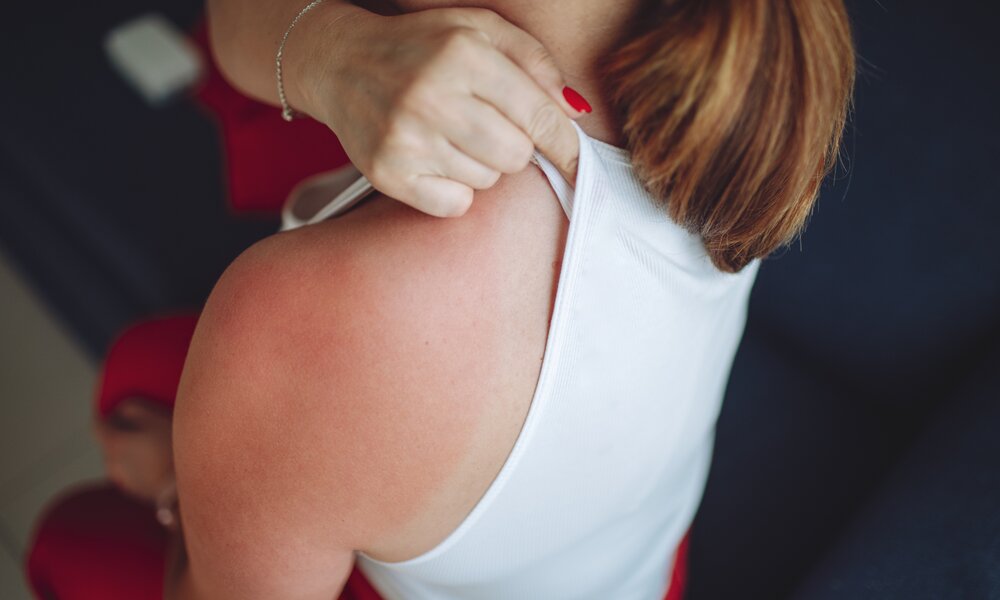Frau juckt sich die Schulter, der Arm und die Schulter sind rot.  | ©  Getty Images / JulPo