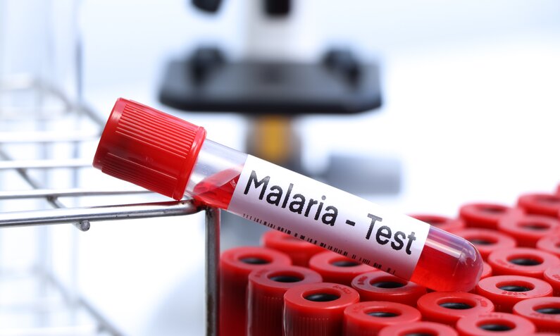 Teströllchen mit Blut für Malaria-Test | ©  Getty Images / Kittisak Kaewchalun